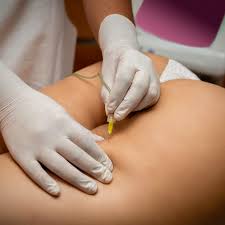 carbossiterapia cellulite