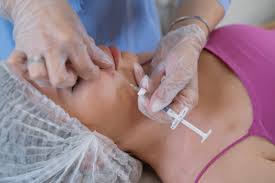 lipofilling facciale