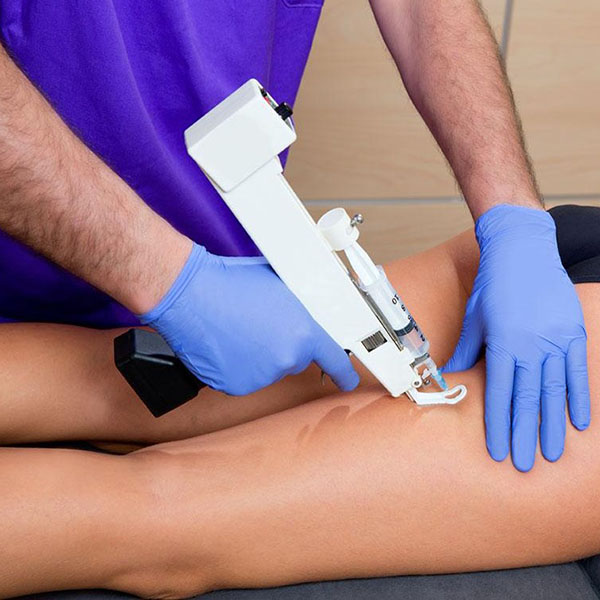 mesoterapia capillare