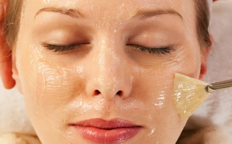 peeling chimico viso